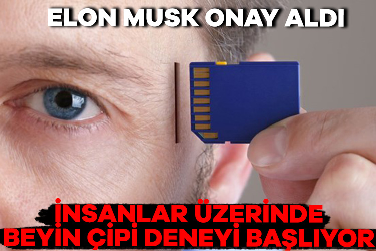 Elon Musk’ın Neuralink şirketinin